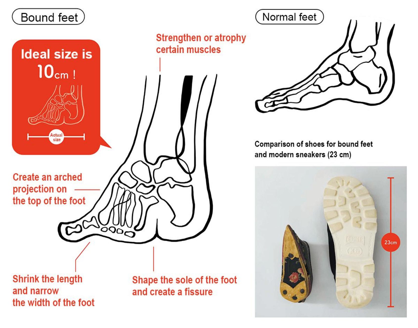 Comparaison entre un pied bandé et un pied normal et entre une chaussure de lotus et une chaussure moderne